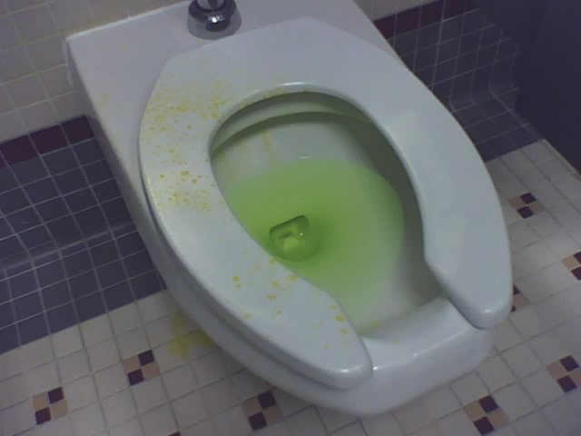 Toilet seat showing why bathroom aim training matters